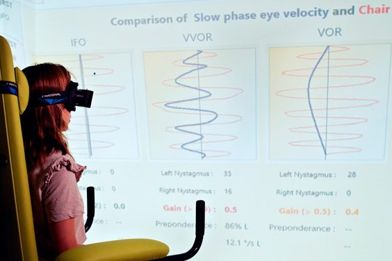 clinica vertigen seccio vertigen foto 2